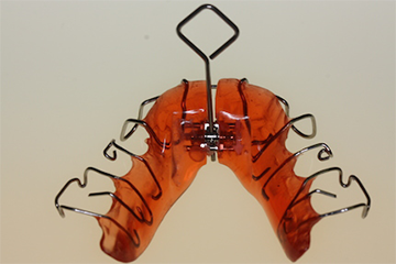 Hilfe für Zahnspangen