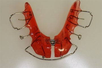 Zahnspangen SOS Hilfe