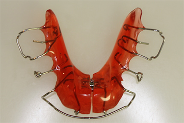 Hilfe bei Zahnspangen Schmerzen