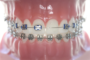 Dr. Christina Welscher - Fachzahnärztin für Kieferorthopädie