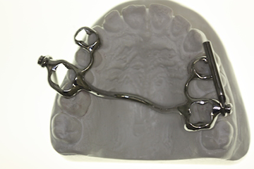 SUS bei Zahnspangen Hilfe